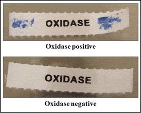 what does oxidase positive mean|Oxidase Test: Principle, Procedure, Results • Microbe Online.